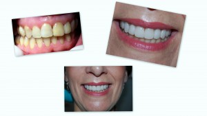 estetica dental